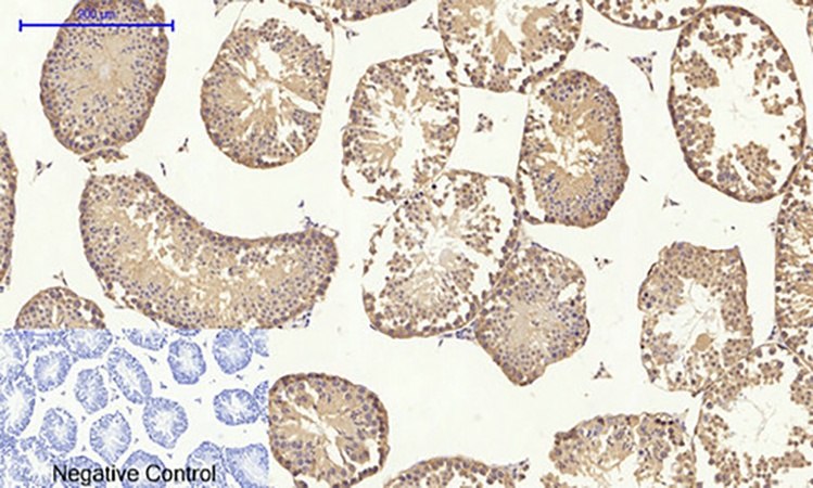Fig.5. Immunohistochemical analysis of paraffin-embedded mouse testis tissue. 1, IGF-IR Polyclonal Antibody was diluted at 1:200 (4°C, overnight). 2, Sodium citrate pH 6.0 was used for antibody retrieval (>98°C, 20min). 3, secondary antibody was diluted at 1:200 (room temperature, 30min). Negative control was used by secondary antibody only.