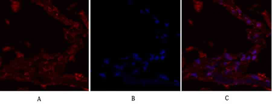 Fig.2. Immunofluorescence analysis of human lung tissue. 1, IRS-1 Polyclonal Antibody (red) was diluted at 1:200 (4°C, overnight). 2, Cy3 Labeled secondary antibody was diluted at 1:300 (room temperature, 50min). 3, Picture B: DAPI (blue) 10min. Picture A: Target. Picture B: DAPI. Picture C: merge of A+B.