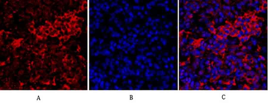 Fig.3. Immunofluorescence analysis of mouse lung tissue. 1, IRS-1 Polyclonal Antibody (red) was diluted at 1:200 (4°C, overnight). 2, Cy3 Labeled secondary antibody was diluted at 1:300 (room temperature, 50min). 3, Picture B: DAPI (blue) 10min. Picture A: Target. Picture B: DAPI. Picture C: merge of A+B.