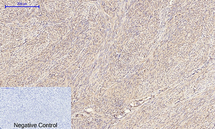 Fig.5. Immunohistochemical analysis of paraffin-embedded human uterus tissue. 1, IRS-1 Polyclonal Antibody was diluted at 1:200 (4°C, overnight). 2, Sodium citrate pH 6.0 was used for antibody retrieval (>98°C, 20min). 3, secondary antibody was diluted at 1:200 (room temperature, 30min). Negative control was used by secondary antibody only.
