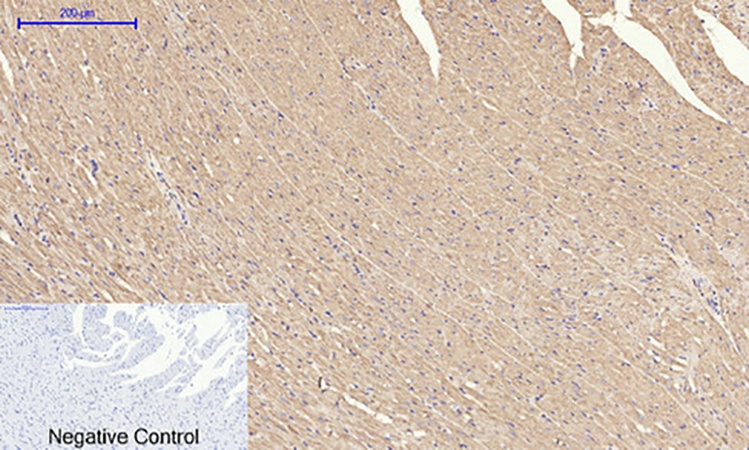 Fig.7. Immunohistochemical analysis of paraffin-embedded rat heart tissue. 1, IRS-1 Polyclonal Antibody was diluted at 1:200 (4°C, overnight). 2, Sodium citrate pH 6.0 was used for antibody retrieval (>98°C, 20min). 3, secondary antibody was diluted at 1:200 (room temperature, 30min). Negative control was used by secondary antibody only.