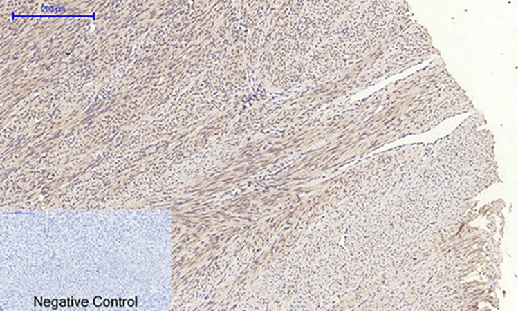 Fig.3. Immunohistochemical analysis of paraffin-embedded human uterus tissue. 1, JAK1 Polyclonal Antibody was diluted at 1:200 (4°C, overnight). 2, Sodium citrate pH 6.0 was used for antibody retrieval (>98°C, 20min). 3, secondary antibody was diluted at 1:200 (room temperature, 30min). Negative control was used by secondary antibody only.