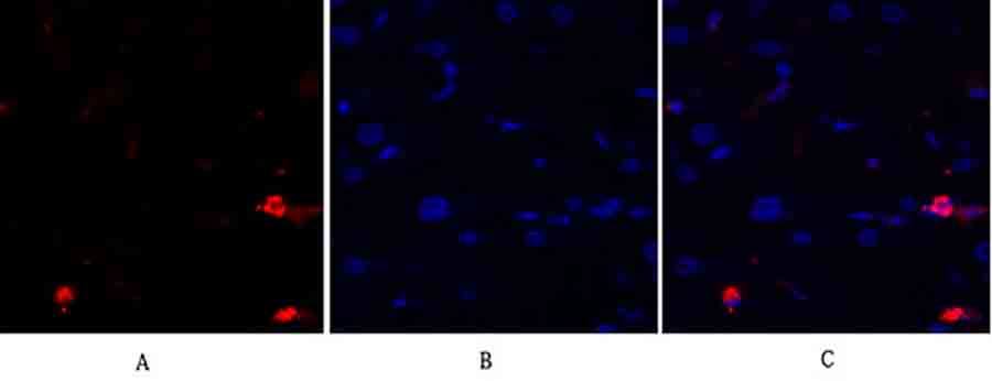 Fig.1. Immunofluorescence analysis of human liver tissue. 1, JNK1/2/3 Polyclonal Antibody (red) was diluted at 1:200 (4°C, overnight). 2, Cy3 Labeled secondary antibody was diluted at 1:300 (room temperature, 50min). 3, Picture B: DAPI (blue) 10min. Picture A: Target. Picture B: DAPI. Picture C: merge of A+B.