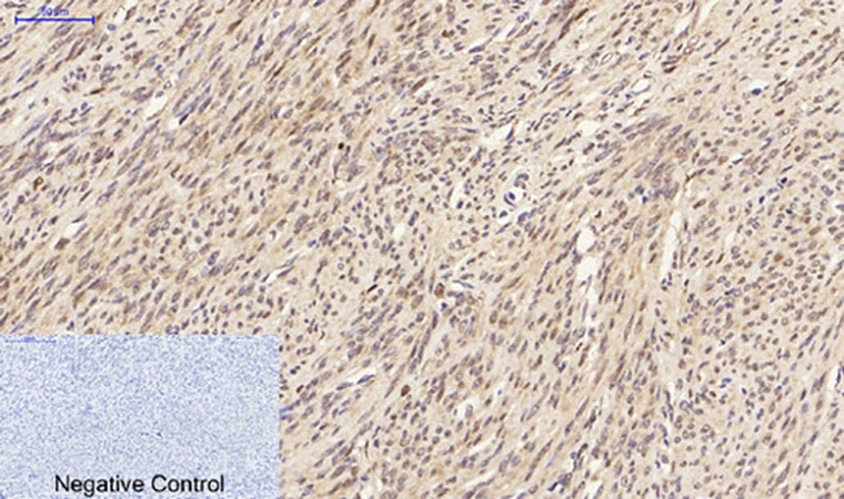 Fig.3. Immunohistochemical analysis of paraffin-embedded human uterus tissue. 1, JNK1/2/3 Polyclonal Antibody was diluted at 1:200 (4°C, overnight). 2, Sodium citrate pH 6.0 was used for antibody retrieval (>98°C, 20min). 3, secondary antibody was diluted at 1:200 (room temperature, 30min). Negative control was used by secondary antibody only.