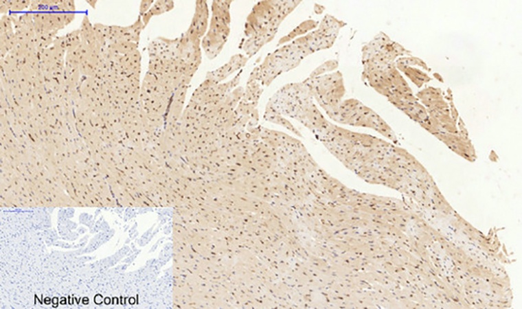 Fig.5. Immunohistochemical analysis of paraffin-embedded rat heart tissue. 1, JNK1/2/3 Polyclonal Antibody was diluted at 1:200 (4°C, overnight). 2, Sodium citrate pH 6.0 was used for antibody retrieval (>98°C, 20min). 3, secondary antibody was diluted at 1:200 (room temperature, 30min). Negative control was used by secondary antibody only.