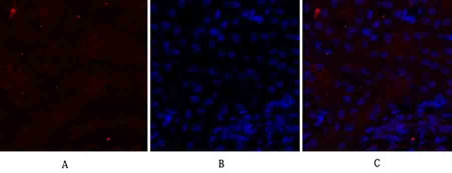Fig.2. Immunofluorescence analysis of mouse kidney tissue. 1, N-cadherin Polyclonal Antibody (red) was diluted at 1:200 (4°C, overnight). 2, Cy3 Labeled secondary antibody was diluted at 1:300 (room temperature, 50min). 3, Picture B: DAPI (blue) 10min. Picture A: Target. Picture B: DAPI. Picture C: merge of A+B.