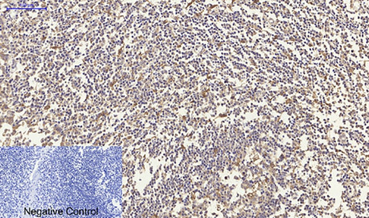 Fig.4. Immunohistochemical analysis of paraffin-embedded human tonsil tissue. 1, N-cadherin Polyclonal Antibody was diluted at 1:200 (4°C, overnight). 2, Sodium citrate pH 6.0 was used for antibody retrieval (>98°C, 20min). 3, secondary antibody was diluted at 1:200 (room temperature, 30min). Negative control was used by secondary antibody only.