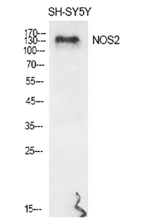 Fig.1. Western Blot analysis of various cells using NOS2 Polyclonal Antibody diluted at 1:500.
