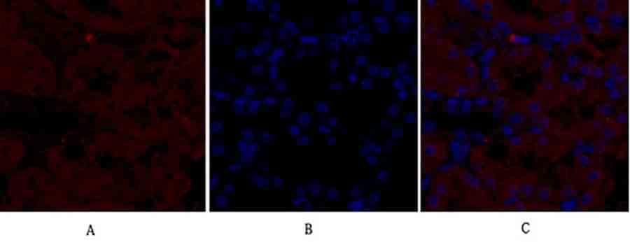 Fig.3. Immunofluorescence analysis of rat kidney tissue. 1, NOS2 Polyclonal Antibody (red) was diluted at 1:200 (4°C, overnight). 2, Cy3 Labeled secondary antibody was diluted at 1:300 (room temperature, 50min). 3, Picture B: DAPI (blue) 10min. Picture A: Target. Picture B: DAPI. Picture C: merge of A+B.
