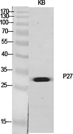 Fig.1. Western Blot analysis of various cells using p27 Polyclonal Antibody diluted at 1:500.