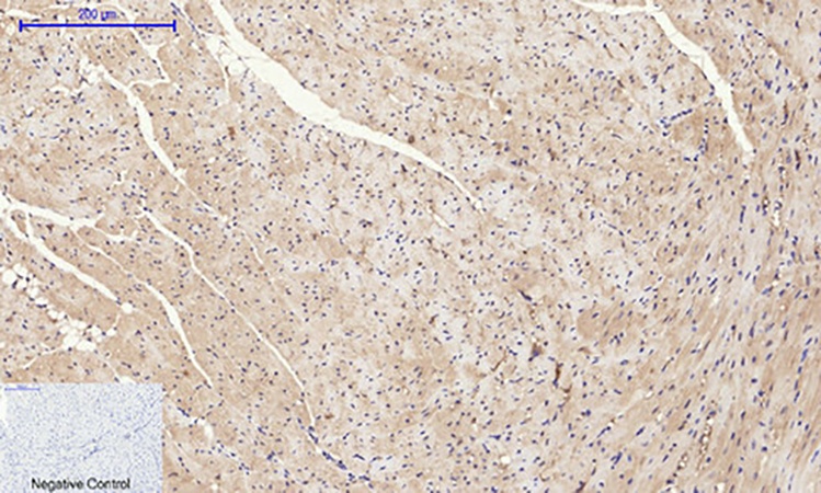 Fig.5. Immunohistochemical analysis of paraffin-embedded mouse heart tissue. 1, PI 3-kinase p110α Polyclonal Antibody was diluted at 1:200 (4°C, overnight). 2, Sodium citrate pH 6.0 was used for antibody retrieval (>98°C, 20min). 3, secondary antibody was diluted at 1:200 (room temperature, 30min). Negative control was used by secondary antibody only.