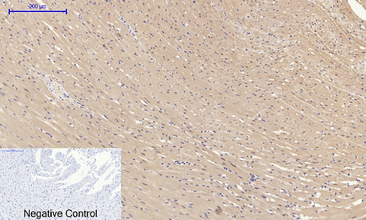 Fig.6. Immunohistochemical analysis of paraffin-embedded rat heart tissue. 1, PI 3-kinase p110α Polyclonal Antibody was diluted at 1:200 (4°C, overnight). 2, Sodium citrate pH 6.0 was used for antibody retrieval (>98°C, 20min). 3, secondary antibody was diluted at 1:200 (room temperature, 30min). Negative control was used by secondary antibody only.