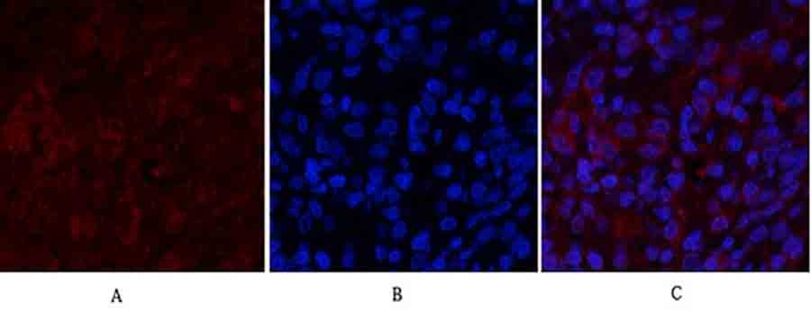 Fig.3. Immunofluorescence analysis of rat lung tissue. 1,  PI 3-kinase p85α Polyclonal Antibody (red) was diluted at 1:200 (4°C, overnight). 2,  Cy3 Labeled secondary antibody was diluted at 1:300 (room temperature, 50min). 3, Picture B: DAPI (blue) 10min. Picture A: Target. Picture B: DAPI. Picture C: merge of A+B.