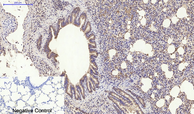 Fig.5. Immunohistochemical analysis of paraffin-embedded rat lung tissue. 1,  PI 3-kinase p85α Polyclonal Antibody was diluted at 1:200 (4°C, overnight). 2,  Sodium citrate pH 6.0 was used for antibody retrieval (>98°C, 20min). 3, secondary antibody was diluted at 1:200 (room temperature, 30min). Negative control was used by secondary antibody only.