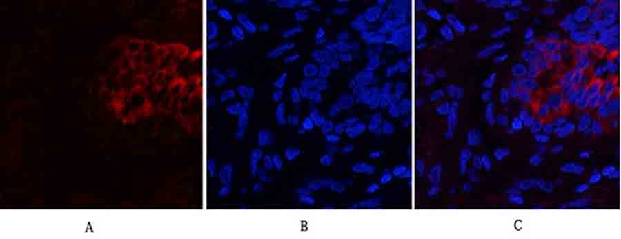 Fig.2. Immunofluorescence analysis of human lung tissue. 1, PI 3-kinase p85α/γ Polyclonal Antibody (red) was diluted at 1:200 (4°C, overnight). 2, Cy3 Labeled secondary antibody was diluted at 1:300 (room temperature, 50min). 3, Picture B: DAPI (blue) 10min. Picture A: Target. Picture B: DAPI. Picture C: merge of A+B.