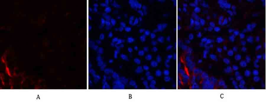 Fig.3. Immunofluorescence analysis of rat lung tissue. 1, PI 3-kinase p85α/γ Polyclonal Antibody (red) was diluted at 1:200 (4°C, overnight). 2, Cy3 Labeled secondary antibody was diluted at 1:300 (room temperature, 50min). 3, Picture B: DAPI (blue) 10min. Picture A: Target. Picture B: DAPI. Picture C: merge of A+B.