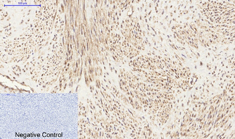 Fig.4. Immunohistochemical analysis of paraffin-embedded human uterus tissue. 1, PI 3-kinase p85α/γ Polyclonal Antibody was diluted at 1:200 (4°C, overnight). 2, Sodium citrate pH 6.0 was used for antibody retrieval (>98°C, 20min). 3, secondary antibody was diluted at 1:200 (room temperature, 30min). Negative control was used by secondary antibody only.