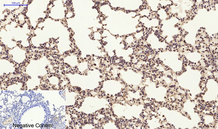 Fig.5. Immunohistochemical analysis of paraffin-embedded mouse lung tissue. 1, PI 3-kinase p85α/γ Polyclonal Antibody was diluted at 1:200 (4°C, overnight). 2, Sodium citrate pH 6.0 was used for antibody retrieval (>98°C, 20min). 3, secondary antibody was diluted at 1:200 (room temperature, 30min). Negative control was used by secondary antibody only.
