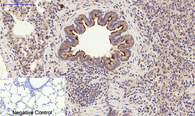 Fig.6. Immunohistochemical analysis of paraffin-embedded rat lung tissue. 1, PI 3-kinase p85α/γ Polyclonal Antibody was diluted at 1:200 (4°C, overnight). 2, Sodium citrate pH 6.0 was used for antibody retrieval (>98°C, 20min). 3, secondary antibody was diluted at 1:200 (room temperature, 30min). Negative control was used by secondary antibody only.
