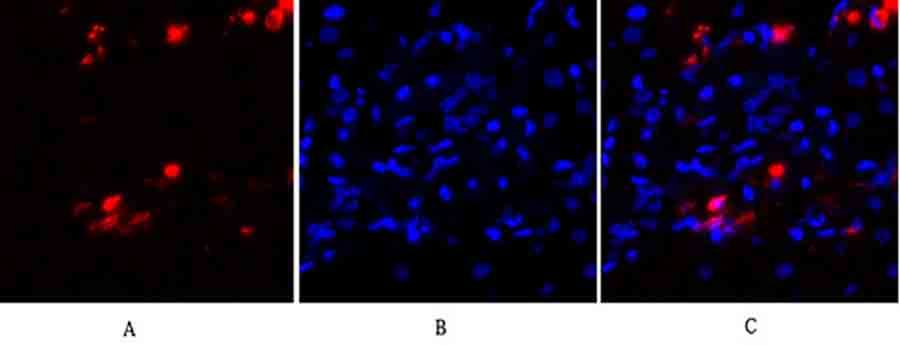 Fig.2. Immunofluorescence analysis of human liver tissue. 1, PKC Polyclonal Antibody (red) was diluted at 1:200 (4°C, overnight). 2, Cy3 Labeled secondary antibody was diluted at 1:300 (room temperature, 50min). 3, Picture B: DAPI (blue) 10min. Picture A: Target. Picture B: DAPI. Picture C: merge of A+B.