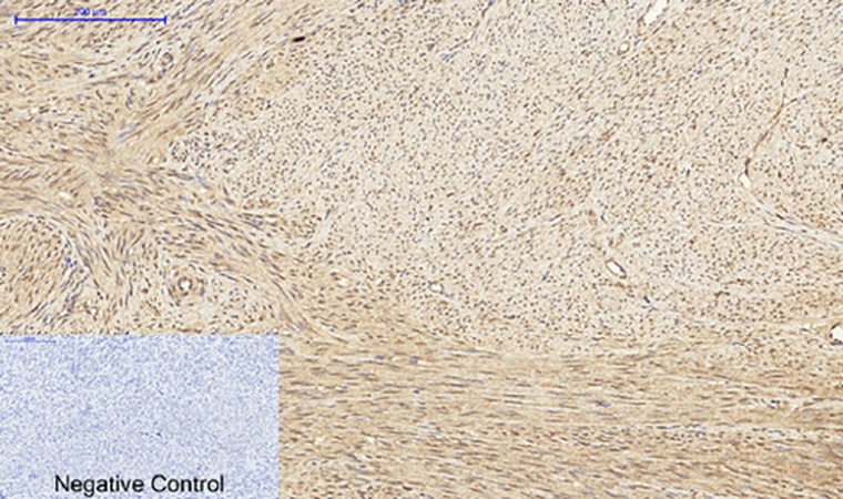 Fig.3. Immunohistochemical analysis of paraffin-embedded human uterus tissue. 1, PKC Polyclonal Antibody was diluted at 1:200 (4°C, overnight). 2, Sodium citrate pH 6.0 was used for antibody retrieval (>98°C, 20min). 3, secondary antibody was diluted at 1:200 (room temperature, 30min). Negative control was used by secondary antibody only.