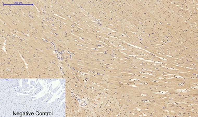 Fig.5. Immunohistochemical analysis of paraffin-embedded rat heart tissue. 1, PKC Polyclonal Antibody was diluted at 1:200 (4°C, overnight). 2, Sodium citrate pH 6.0 was used for antibody retrieval (>98°C, 20min). 3, secondary antibody was diluted at 1:200 (room temperature, 30min). Negative control was used by secondary antibody only.