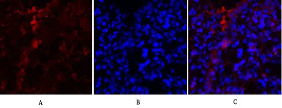 Fig.2. Immunofluorescence analysis of rat lung tissue. 1, PKM2 Polyclonal Antibody (red) was diluted at 1:200 (4°C, overnight). 2, Cy3 Labeled secondary antibody was diluted at 1:300 (room temperature, 50min). 3, Picture B: DAPI (blue) 10min. Picture A: Target. Picture B: DAPI. Picture C: merge of A+B.