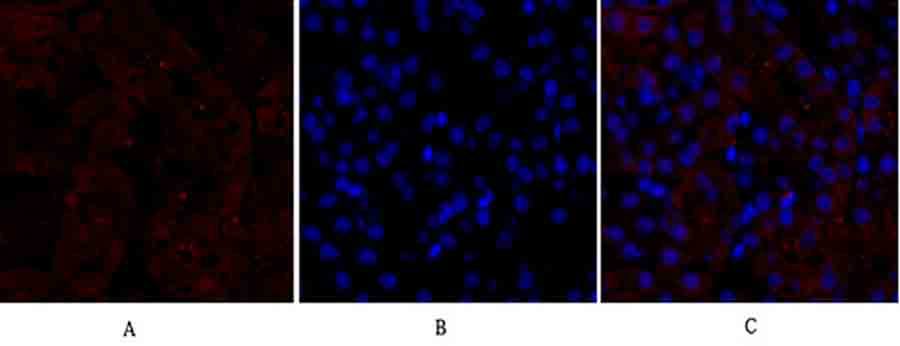 Fig.2. Immunofluorescence analysis of mouse kidney tissue. 1, PPAR-γ Polyclonal Antibody (red) was diluted at 1:200 (4°C, overnight). 2, Cy3 Labeled secondary antibody was diluted at 1:300 (room temperature, 50min). 3, Picture B: DAPI (blue) 10min. Picture A: Target. Picture B: DAPI. Picture C: merge of A+B.