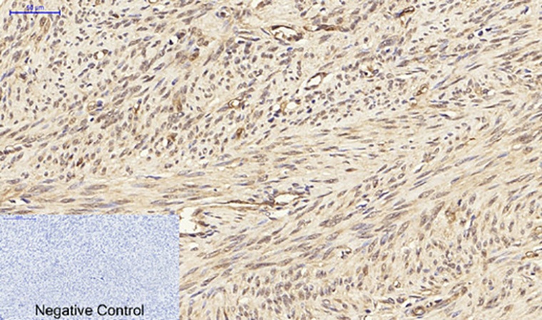 Fig.4. Immunohistochemical analysis of paraffin-embedded human uterus tissue. 1, PPAR-γ Polyclonal Antibody was diluted at 1:200 (4°C, overnight). 2, Sodium citrate pH 6.0 was used for antibody retrieval (>98°C, 20min). 3, secondary antibody was diluted at 1:200 (room temperature, 30min). Negative control was used by secondary antibody only.
