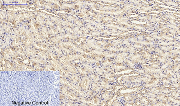 Fig.6. Immunohistochemical analysis of paraffin-embedded rat kidney tissue. 1, PPAR-γ Polyclonal Antibody was diluted at 1:200 (4°C, overnight). 2, Sodium citrate pH 6.0 was used for antibody retrieval (>98°C, 20min). 3, secondary antibody was diluted at 1:200 (room temperature, 30min). Negative control was used by secondary antibody only.