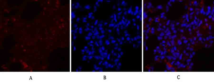 Fig.3. Immunofluorescence analysis of rat lung tissue. 1, Rho A Polyclonal Antibody (red) was diluted at 1:200 (4°C, overnight). 2, Cy3 Labeled secondary antibody was diluted at 1:300 (room temperature, 50min). 3, Picture B: DAPI (blue) 10min. Picture A: Target. Picture B: DAPI. Picture C: merge of A+B.