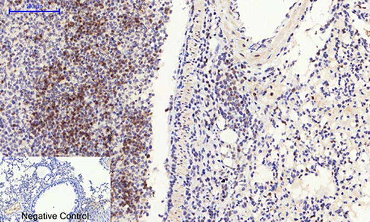 Fig.5. Immunohistochemical analysis of paraffin-embedded mouse lung tissue. 1, Rho A Polyclonal Antibody was diluted at 1:200 (4°C, overnight). 2, Sodium citrate pH 6.0 was used for antibody retrieval (>98°C, 20min). 3, secondary antibody was diluted at 1:200 (room temperature, 30min). Negative control was used by secondary antibody only.