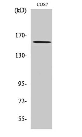 Fig.1. Western Blot analysis of various cells using Rock-1 Polyclonal Antibody diluted at 1:2000.