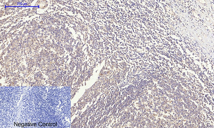 Fig.3. Immunohistochemical analysis of paraffin-embedded human tonsil tissue. 1, Rock-1 Polyclonal Antibody was diluted at 1:200 (4°C, overnight). 2, Sodium citrate pH 6.0 was used for antibody retrieval (>98°C, 20min). 3, secondary antibody was diluted at 1:200 (room temperature, 30min). Negative control was used by secondary antibody only.