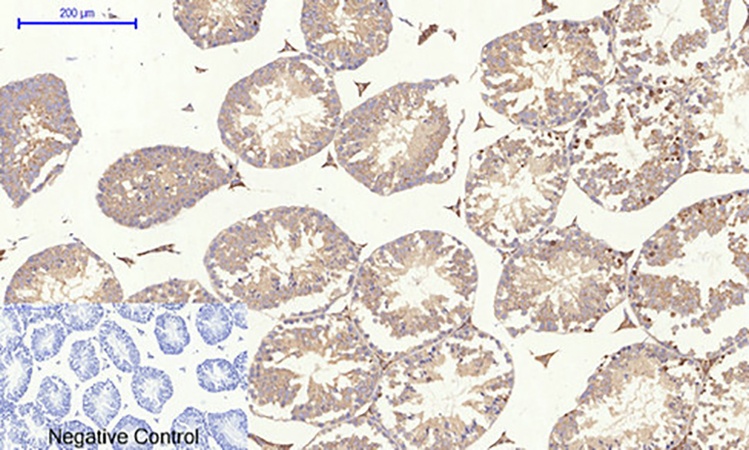 Fig.4. Immunohistochemical analysis of paraffin-embedded mouse testis tissue. 1, Rock-1 Polyclonal Antibody was diluted at 1:200 (4°C, overnight). 2, Sodium citrate pH 6.0 was used for antibody retrieval (>98°C, 20min). 3, secondary antibody was diluted at 1:200 (room temperature, 30min). Negative control was used by secondary antibody only.