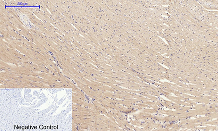 Fig.5. Immunohistochemical analysis of paraffin-embedded rat heart tissue. 1, Rock-1 Polyclonal Antibody was diluted at 1:200 (4°C, overnight). 2, Sodium citrate pH 6.0 was used for antibody retrieval (>98°C, 20min). 3, secondary antibody was diluted at 1:200 (room temperature, 30min). Negative control was used by secondary antibody only.