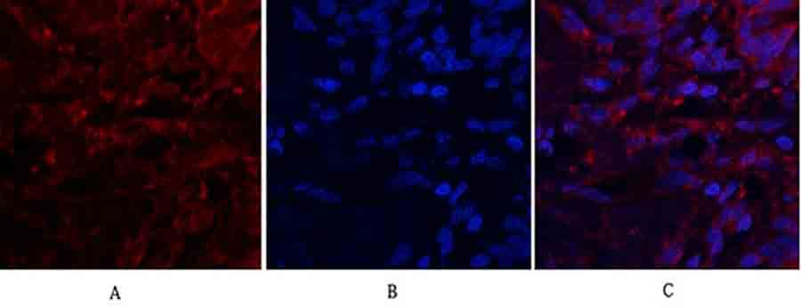 Fig.2. Immunofluorescence analysis of human lung tissue. 1, SDF-1 Polyclonal Antibody (red) was diluted at 1:200 (4°C, overnight). 2, Cy3 Labeled secondary antibody was diluted at 1:300 (room temperature, 50min). 3, Picture B: DAPI (blue) 10min. Picture A: Target. Picture B: DAPI. Picture C: merge of A+B.