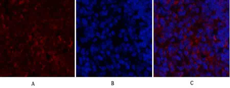 Fig.3. Immunofluorescence analysis of rat spleen tissue. 1, SDF-1 Polyclonal Antibody (red) was diluted at 1:200 (4°C, overnight). 2, Cy3 Labeled secondary antibody was diluted at 1:300 (room temperature, 50min). 3, Picture B: DAPI (blue) 10min. Picture A: Target. Picture B: DAPI. Picture C: merge of A+B.
