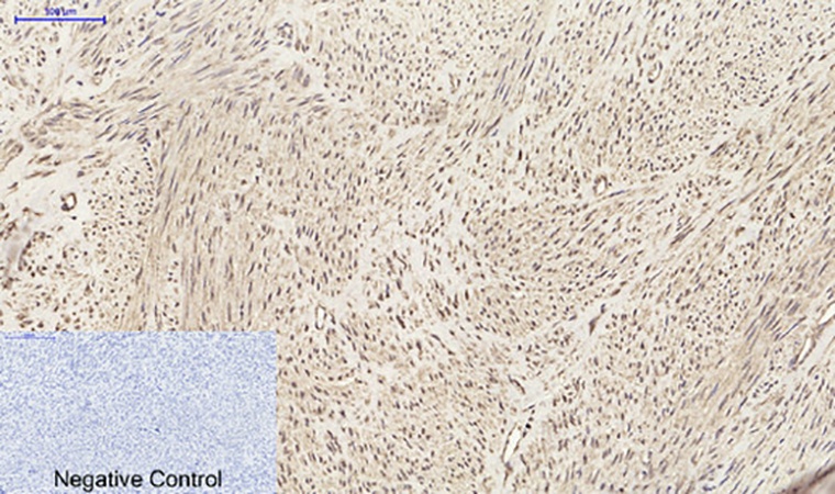 Fig.4. Immunohistochemical analysis of paraffin-embedded human uterus tissue. 1, SDF-1 Polyclonal Antibody was diluted at 1:200 (4°C, overnight). 2, Sodium citrate pH 6.0 was used for antibody retrieval (>98°C, 20min). 3, secondary antibody was diluted at 1:200 (room temperature, 30min). Negative control was used by secondary antibody only.