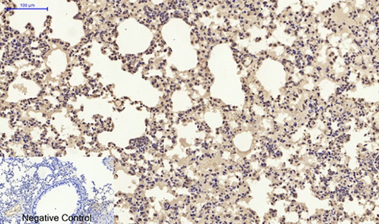 Fig.5. Immunohistochemical analysis of paraffin-embedded mouse lung tissue. 1, SDF-1 Polyclonal Antibody was diluted at 1:200 (4°C, overnight). 2, Sodium citrate pH 6.0 was used for antibody retrieval (>98°C, 20min). 3, secondary antibody was diluted at 1:200 (room temperature, 30min). Negative control was used by secondary antibody only.