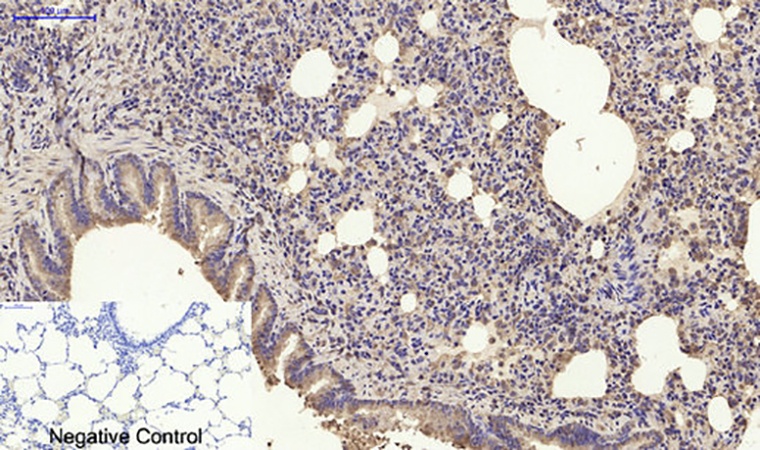 Fig.6. Immunohistochemical analysis of paraffin-embedded rat lung tissue. 1, SDF-1 Polyclonal Antibody was diluted at 1:200 (4°C, overnight). 2, Sodium citrate pH 6.0 was used for antibody retrieval (>98°C, 20min). 3, secondary antibody was diluted at 1:200 (room temperature, 30min). Negative control was used by secondary antibody only.