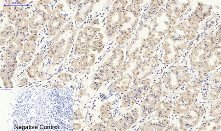Fig.2. Immunohistochemical analysis of paraffin-embedded human stomach tissue. 1, Smad2/3 Polyclonal Antibody was diluted at 1:200 (4°C, overnight). 2, Sodium citrate pH 6.0 was used for antibody retrieval (>98°C, 20min). 3, secondary antibody was diluted at 1:200 (room temperature, 30min). Negative control was used by secondary antibody only.