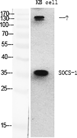 Fig.1. Western Blot analysis of various cells using SOCS-1 Polyclonal Antibody diluted at 1:2000.