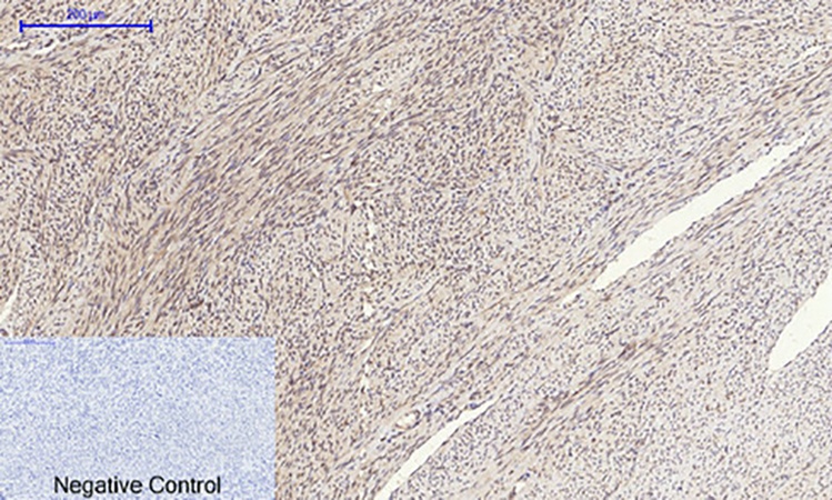Fig.3. Immunohistochemical analysis of paraffin-embedded human uterus tissue. 1, SOCS-1 Polyclonal Antibody was diluted at 1:200 (4°C, overnight). 2, Sodium citrate pH 6.0 was used for antibody retrieval (>98°C, 20min). 3, secondary antibody was diluted at 1:200 (room temperature, 30min). Negative control was used by secondary antibody only.