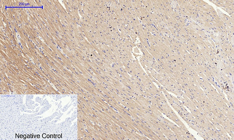 Fig.5. Immunohistochemical analysis of paraffin-embedded rat heart tissue. 1, SOCS-1 Polyclonal Antibody was diluted at 1:200 (4°C, overnight). 2, Sodium citrate pH 6.0 was used for antibody retrieval (>98°C, 20min). 3, secondary antibody was diluted at 1:200 (room temperature, 30min). Negative control was used by secondary antibody only.
