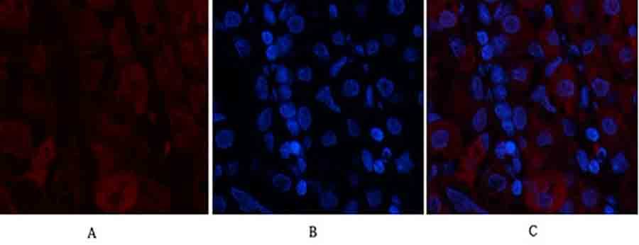 Fig.2. Immunofluorescence analysis of human stomach tissue. 1, Tak1 Polyclonal Antibody (red) was diluted at 1:200 (4°C, overnight). 2, Cy3 Labeled secondary antibody was diluted at 1:300 (room temperature, 50min). 3, Picture B: DAPI (blue) 10min. Picture A: Target. Picture B: DAPI. Picture C: merge of A+B.