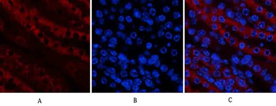 Fig.3. Immunofluorescence analysis of mouse kidney tissue. 1, Tak1 Polyclonal Antibody (red) was diluted at 1:200 (4°C, overnight). 2, Cy3 Labeled secondary antibody was diluted at 1:300 (room temperature, 50min). 3, Picture B: DAPI (blue) 10min. Picture A: Target. Picture B: DAPI. Picture C: merge of A+B.