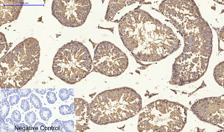 Fig.6. Immunohistochemical analysis of paraffin-embedded mouse testis tissue. 1, Tak1 Polyclonal Antibody was diluted at 1:200 (4°C, overnight). 2, Sodium citrate pH 6.0 was used for antibody retrieval (>98°C, 20min). 3, secondary antibody was diluted at 1:200 (room temperature, 30min). Negative control was used by secondary antibody only.