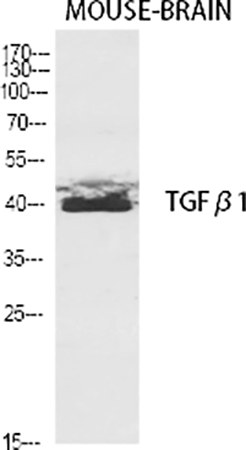 Fig.1. Western Blot analysis of various cells using TGFβ1 Polyclonal Antibody diluted at 1:2000.