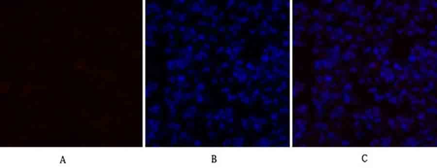 Fig.2. Immunofluorescence analysis of mouse lung tissue. 1, TGFβ1 Polyclonal Antibody (red) was diluted at 1:200 (4°C, overnight). 2, Cy3 Labeled secondary antibody was diluted at 1:300 (room temperature, 50min). 3, Picture B: DAPI (blue) 10min. Picture A: Target. Picture B: DAPI. Picture C: merge of A+B.